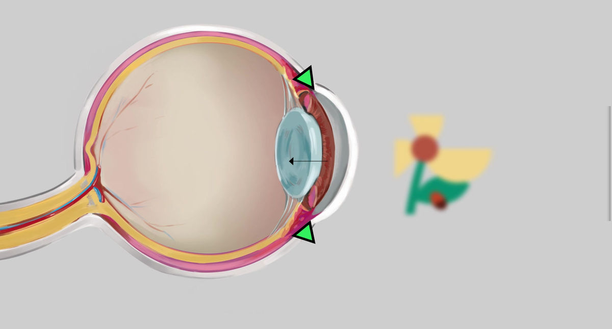 Vision